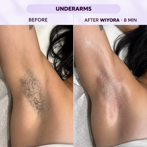 Hair Removal Cream