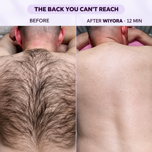 Hair Removal Cream