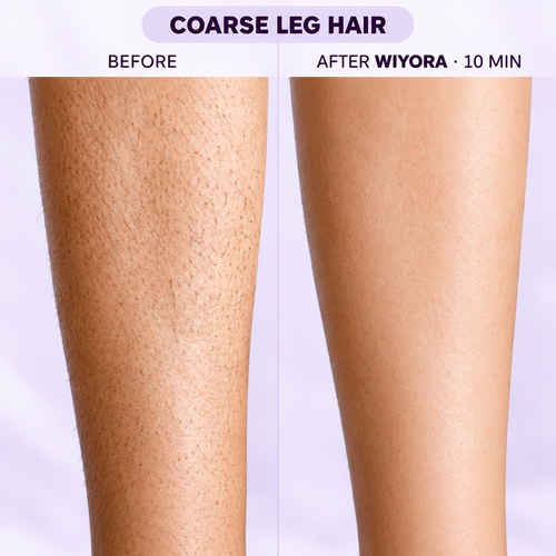Hair Removal Cream